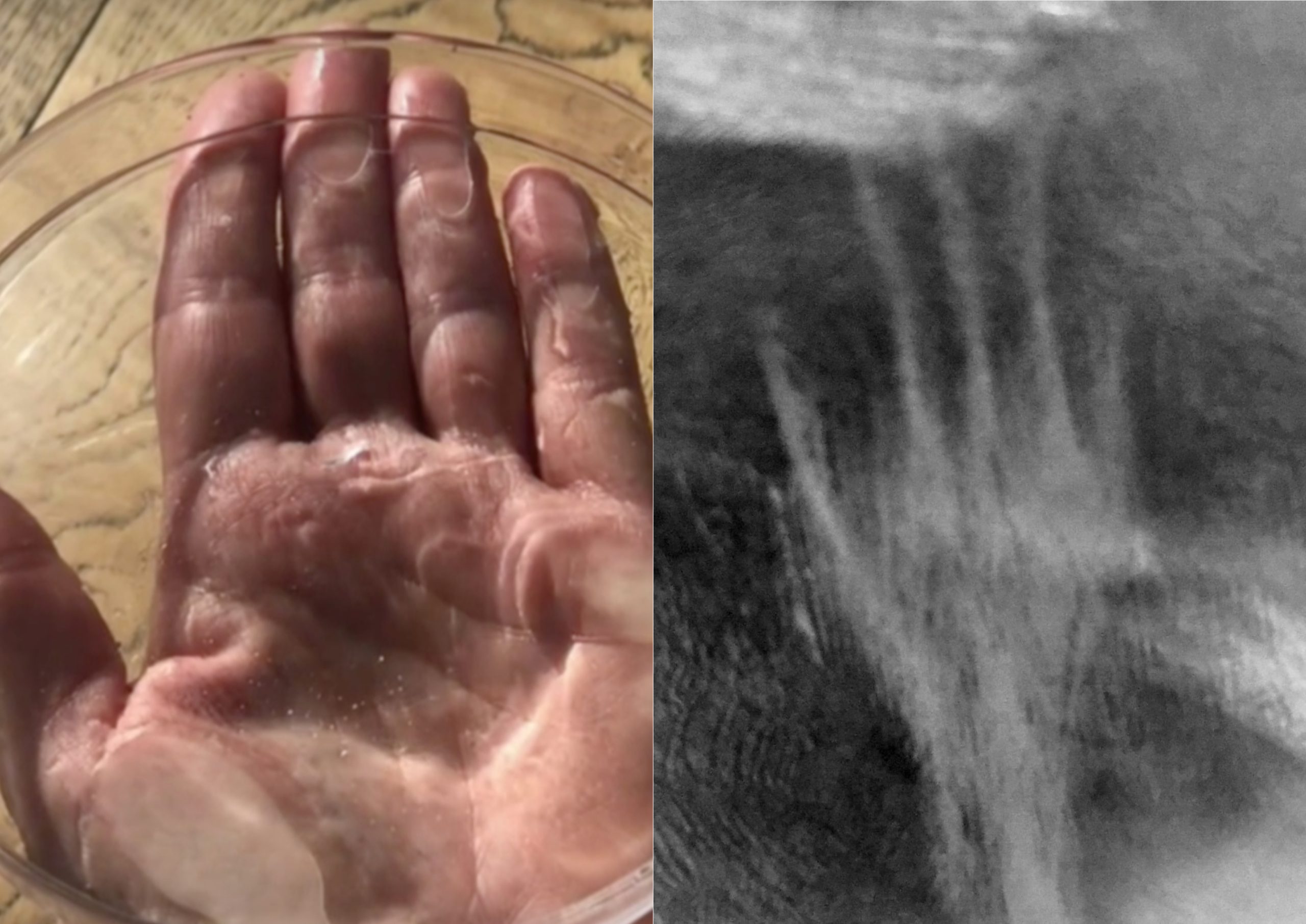 Hand under dish, left, with ice-crystal response, right (Photograph: Veda Austin)
